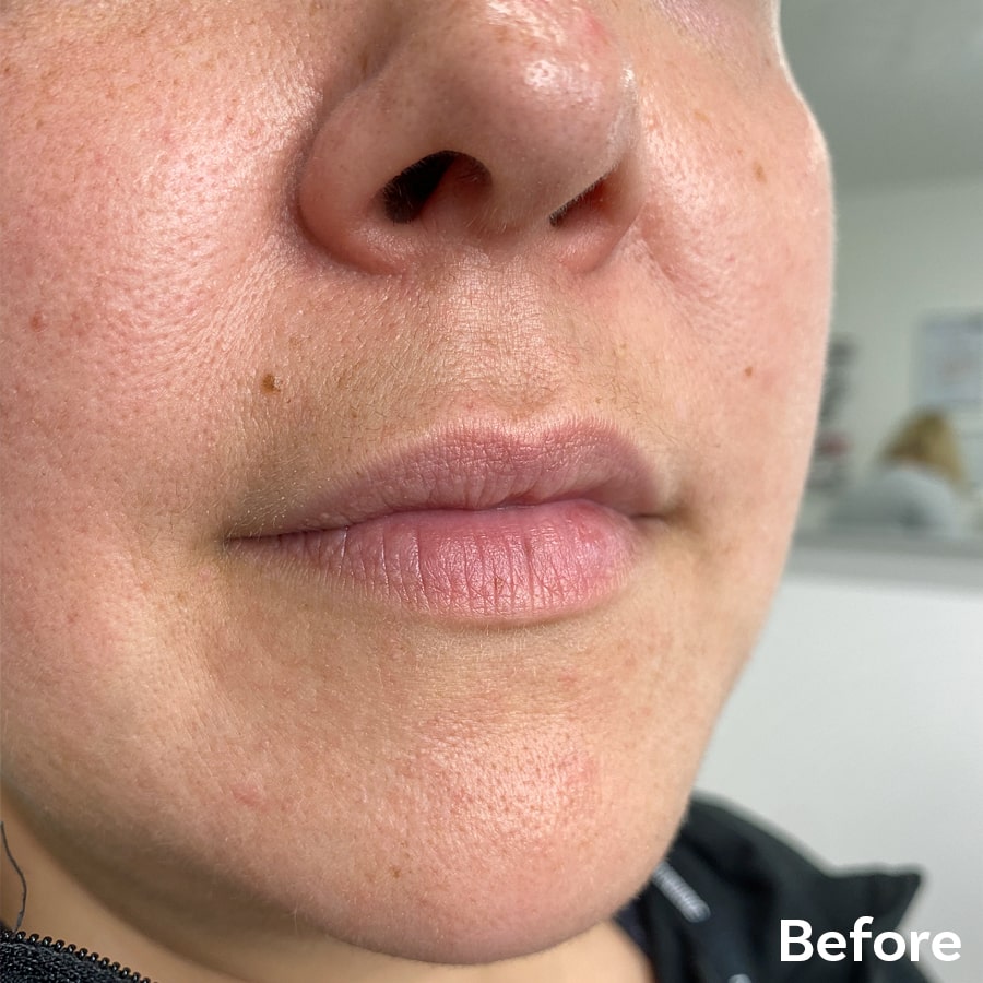 Permanent Makeup Lips Before 1