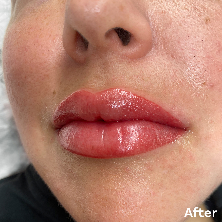 Permanent Makeup Lips After 1