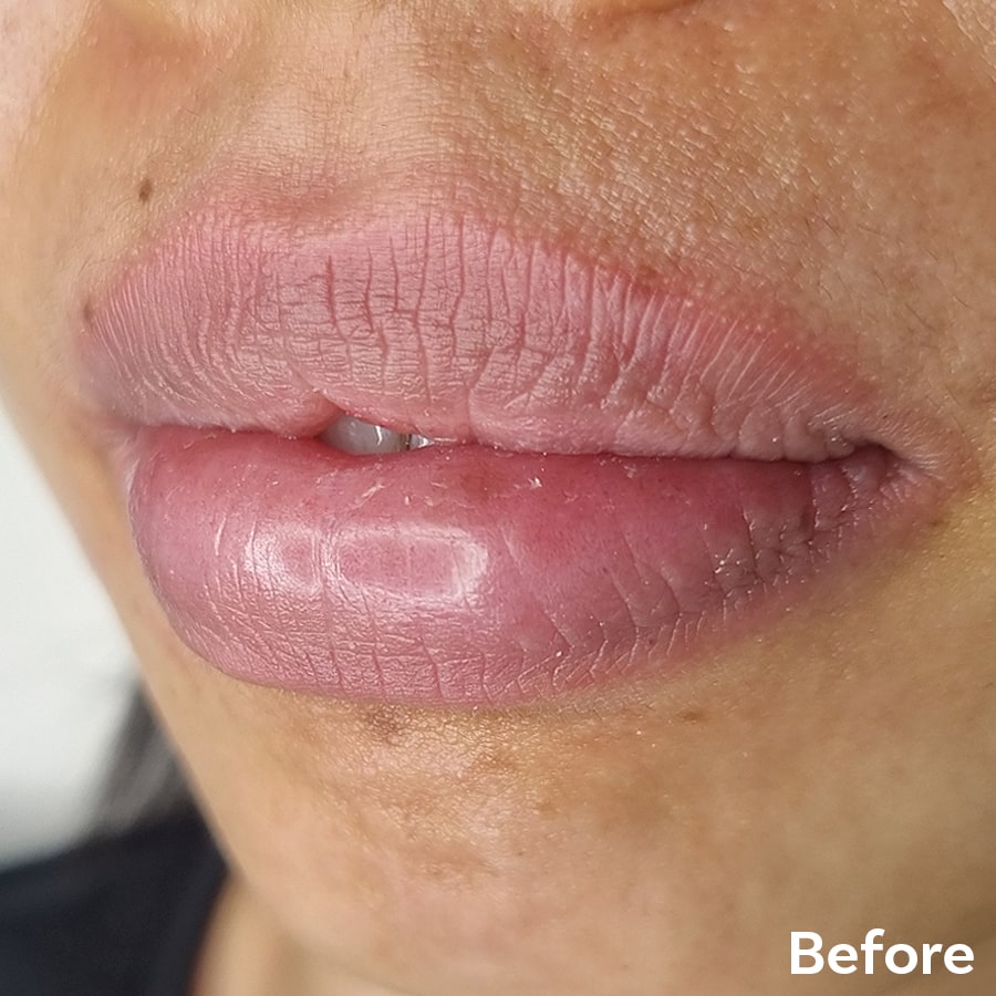 Permanent Makeup Lips Before 3